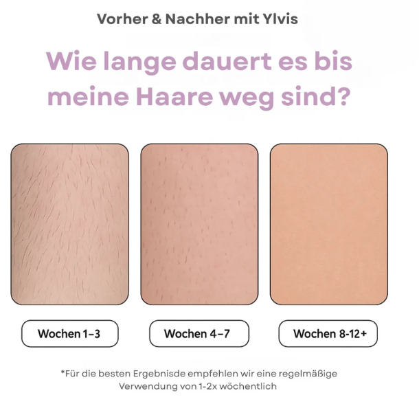 IPL Hair Remover | Die führende Laser-Haar-Entfernung für Zuhause