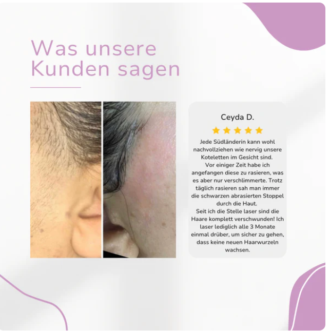 IPL Hair Remover | Die führende Laser-Haar-Entfernung für Zuhause