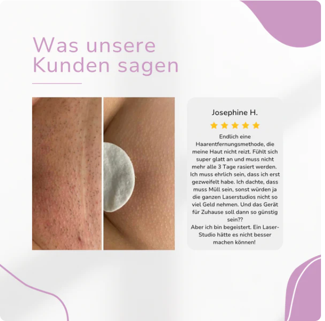 IPL Hair Remover | Die führende Laser-Haar-Entfernung für Zuhause