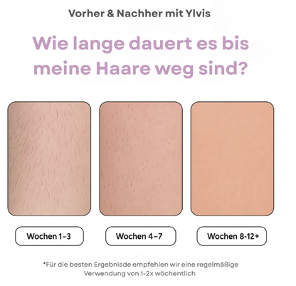 IPL Hair Remover | Die führende Laser-Haar-Entfernung für Zuhause